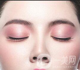果酸嫩膚維持時間