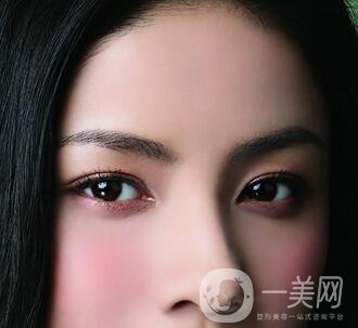 還在離不開雙眼皮貼嗎？雙眼皮手術(shù)助你雙眸