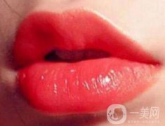 玻尿酸豐唇珠果怎么樣？