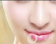 微針祛痘坑會反彈嗎