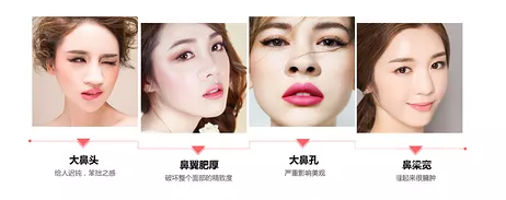鼻翼縮小手術(shù)的價錢