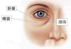 *去眼袋貴嗎 價(jià)格是多少