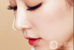 隆鼻價格高嗎？價格是多少？