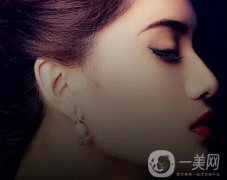隆鼻都有哪幾種？