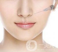 玻尿酸隆鼻多少錢一針？