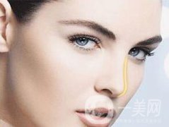 假體隆鼻大概需要多少錢？