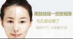 黑臉娃娃的功與作用介紹，關(guān)于皮膚管理的干貨也有哦