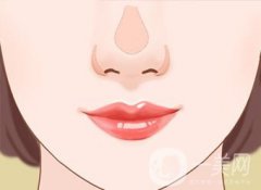 鼻翼縮小價(jià)錢是多少？