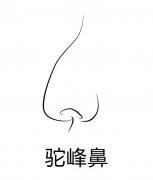 駝峰鼻矯正整形價(jià)格是多少？