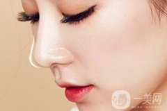 隆鼻價格是多少？隆鼻大概多少錢？