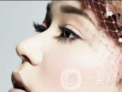 鼻翼縮小手術(shù)整形要多少錢(qián) ?