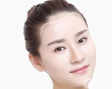 改發(fā)際線價(jià)格是多少？