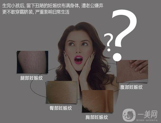 去妊娠紋價錢是多少？