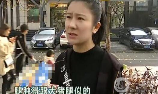 驚！女子花5萬(wàn)整形，大腿留下17厘米疤痕