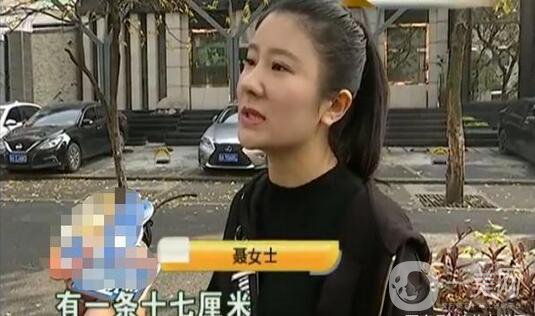 驚！女子花5萬(wàn)整形，大腿留下17厘米疤痕