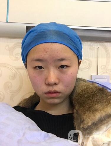 整容到底為了什么？知乎回答扎進心窩