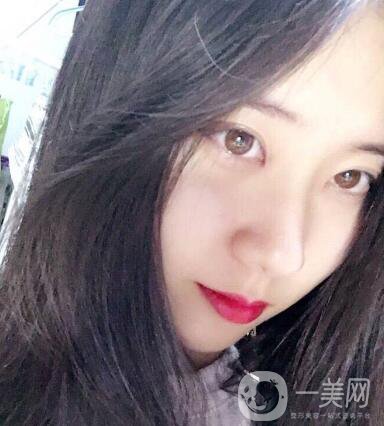 整容到底為了什么？知乎回答扎進心窩