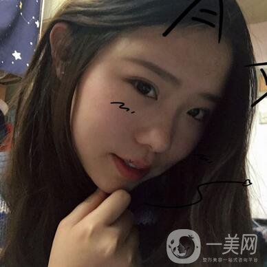 整容到底為了什么？知乎回答扎進心窩