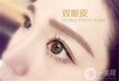 什么叫埋線雙眼皮 埋線雙眼皮怎么樣？
