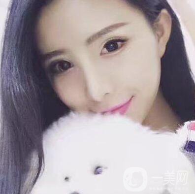什么是芭比眼平行雙眼皮？