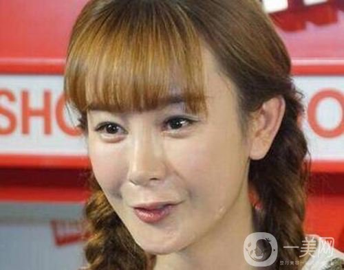 明星整容就是不承認？ 然后突然臉“爛”了！