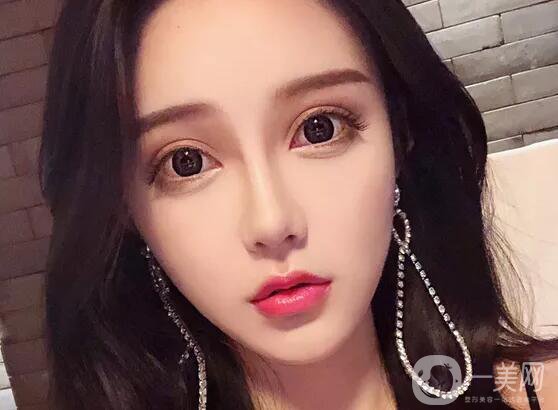 注射隆鼻好嗎 有哪些缺點(diǎn)呢？
