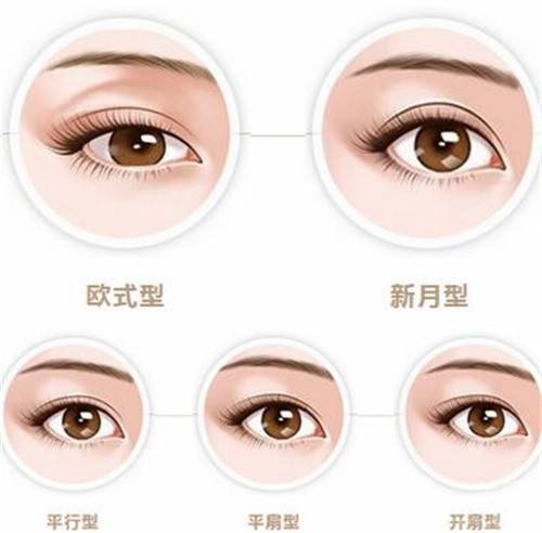 冬季割雙眼皮注意什么？術(shù)后吃什么好？