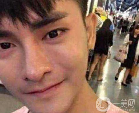 小伙整容數(shù)十次，只為一張韓星臉