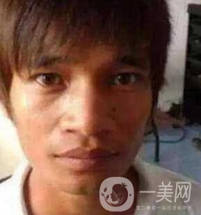 小伙整容數(shù)十次，只為一張韓星臉