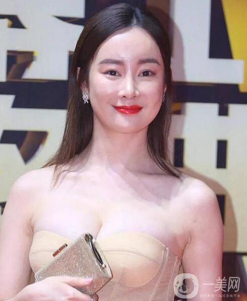 賈靜雯、迪麗熱巴的雙眼皮是不是割的 看了這個你就明白了