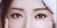 高分子割雙眼皮可以維持多長(zhǎng)時(shí)間呢?注意事項(xiàng)有哪些？