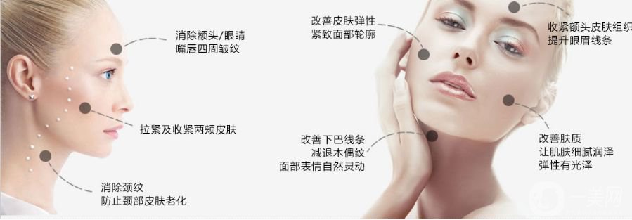 熱瑪吉除皺價格 熱瑪吉除皺*果好嗎