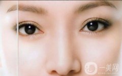 雙眼皮怎么樣？果如何呢？