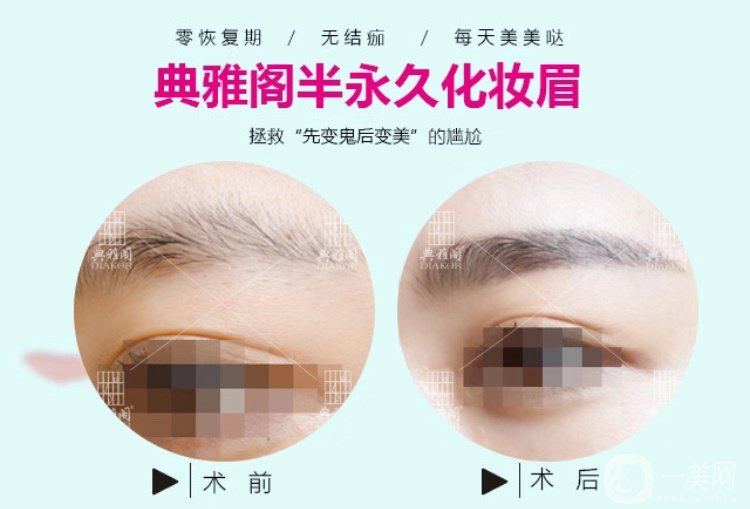昆明典雅閣紋眉怎么樣？