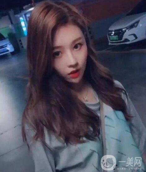 整容為什么越來越火？ 溫婉