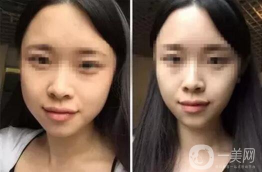 **果好嗎？*前后圖