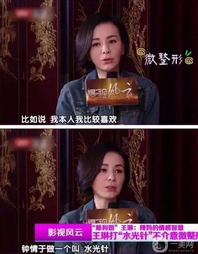 為什么眾多明星都鐘愛(ài)*？