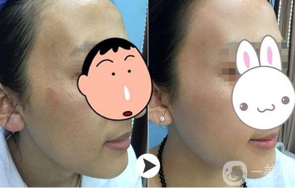 為什么眾多明星都鐘愛(ài)*？