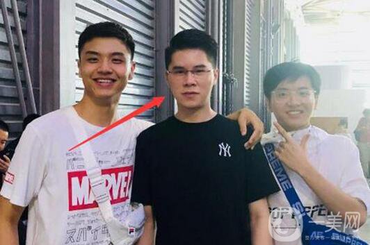 毒紀整容了？國服,刀妹毒紀整容前后