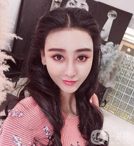 又一個(gè)整容失敗的女明星，鼻子都整歪了，不甘心揚(yáng)言還要植發(fā)！