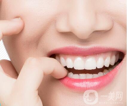 哪種烤瓷牙比較好？他們有什么區(qū)別呢？
