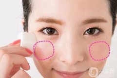 臉頰隆起的原因是什么 手術(shù)怎么做？