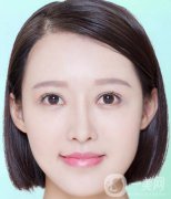 去紅色胎記留疤嗎？有哪些方法可以去胎記呢？