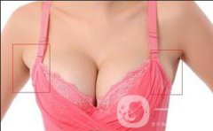 去副乳貴嗎？大概多少錢？