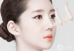 隆鼻哪種好 該如何選擇適合自己的方式？