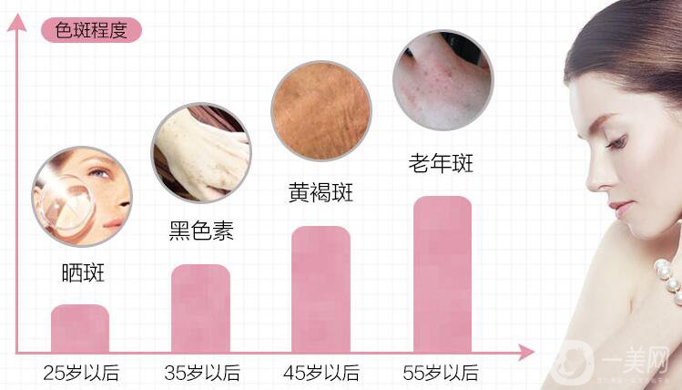 如何調(diào)節(jié)老年斑 都有哪些方式呢？