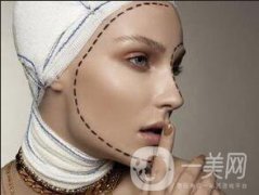 磨骨整形貴嗎？大概多少錢(qián)？
