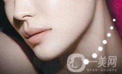 膨體墊下巴貴嗎？大概多少錢(qián)？