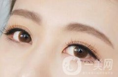 韓式三點(diǎn)雙眼皮價格是多少？和埋線雙眼皮的區(qū)別？