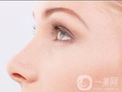 做個(gè)鼻翼縮一次多少錢？影響價(jià)格的因素有哪些？